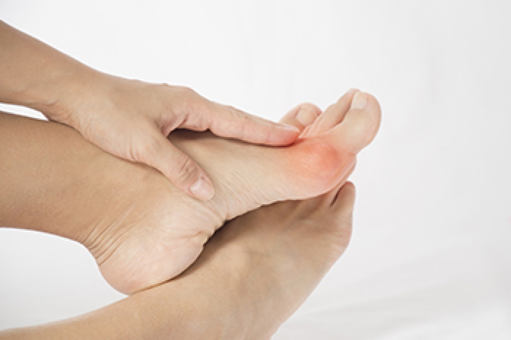 Podiatric Treatment for Painful Bunions