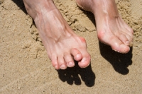 What Causes a Hammertoe?