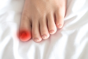 What to Know About Ingrown Toenails