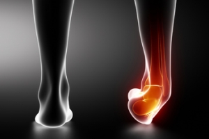 Understanding Ankle Fractures