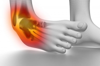 Exercises That Support Recovery After an Ankle Sprain